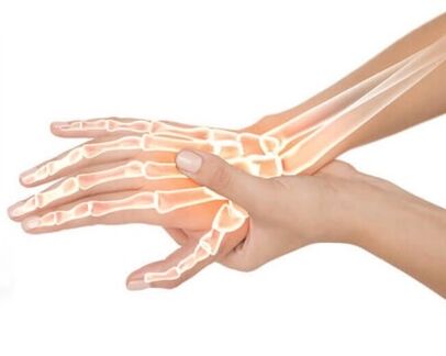 Hondrox се прилага върху засегнатата област