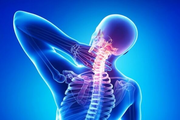 Остеохондроза