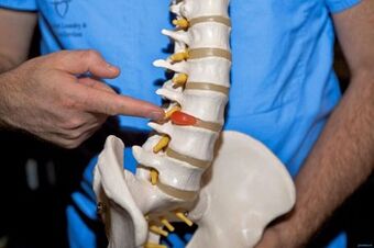 Защо гърбът боли в долната част на гърба и какво да се прави