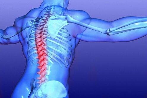 остеохондроза на лумбалния гръбнак