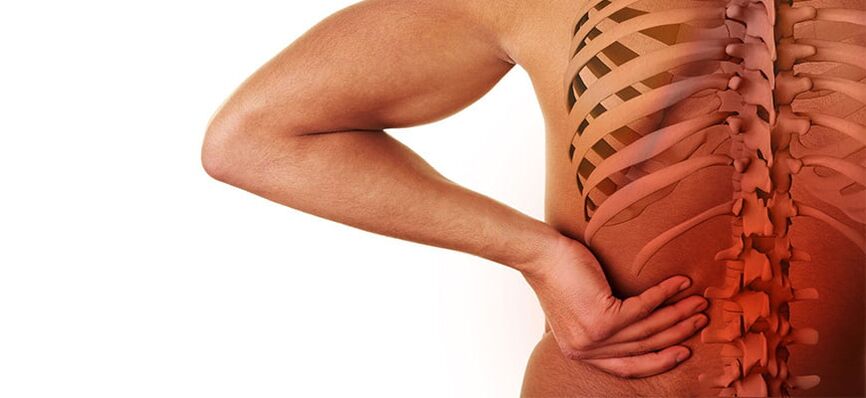 симптоми на лумбална остеохондроза